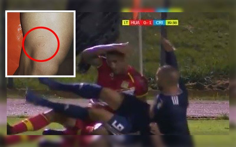 Herrera: "Prefiero que me metan un puñete antes de que me muerdan"