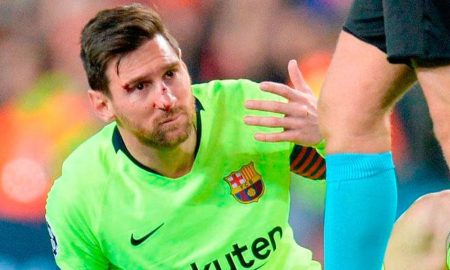 Messi sufrió un golpe en la nariz en el partido ante Manchester.