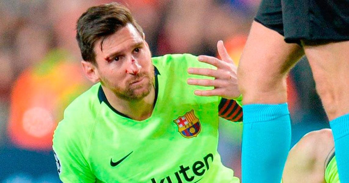 Messi sufrió un golpe en la nariz en el partido ante Manchester.